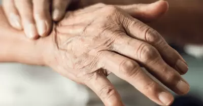 Los s�ntomas pueden iniciar con un temblor apenas perceptible en una sola mano