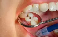 El 90% de la población tiene caries dentales