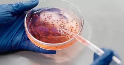Han confirmado tres casos de infección por la bacteria Burkholderia pseudomallei