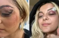 Bebe Rexha es fuertemente golpeada por el celular de un fan