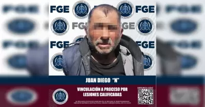 Sujeto que presuntamente lesion� con arma de fuego a una persona