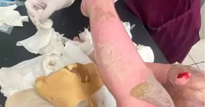 Ni�a