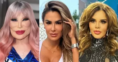 Estas famosas han abusado de las cirug�as est�ticas.
