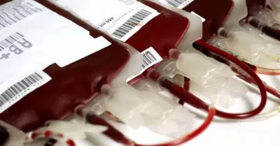 Transfusin Sangunea