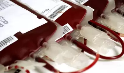 Transfusin Sangunea