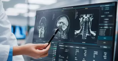 An�lisis de Resonancia Magn�tica del Paciente, Diagn�stico de Cerebro.