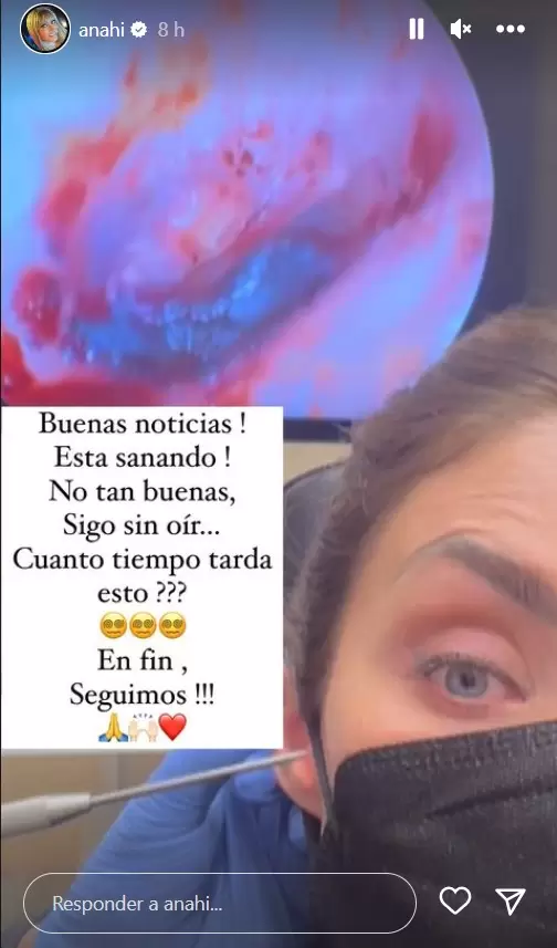Anah� tiene el o�do lastimado.