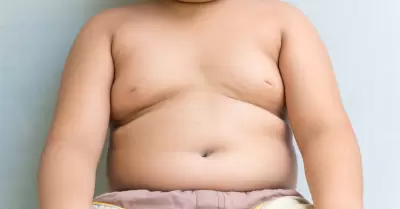 Sobrepeso infantil