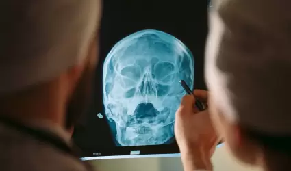 Doctores viendo rayos X de paciente.