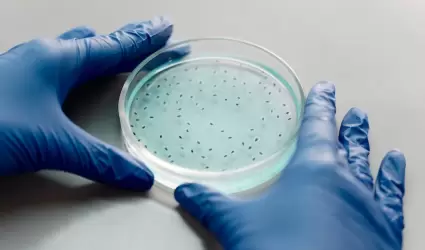 Rara bacteria carnívora sobrevive en aguas saladas