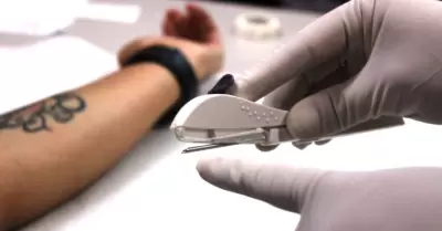 Se capacita personal en la aplicación del implante subdérmico doble varilla