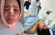 Dan de alta a Paolita Surez del Hospital tras agresin de su pareja