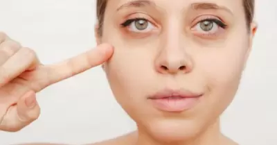 ojeras