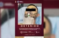 Asesino del "Niño de Las Gelatinas" no se ha presentado ante un juez porque sigue sedado tras ser baleado: FGEBC