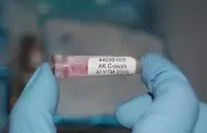 Detectan primer caso humano de Influenza aviar A en M�xico