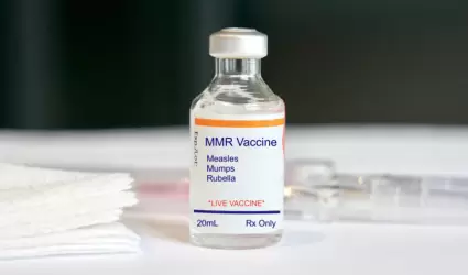Vacuna contra el sarampin