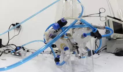 Est�mago artificial, creado por cient�ficos de la UNAM