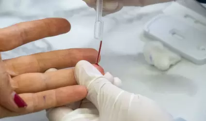 Ofrecen atenci�n integral a pacientes con VIH-SIDA