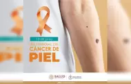 Prec�ncer y c�ncer de piel empieza a detectarse cada vez en personas m�s j�venes