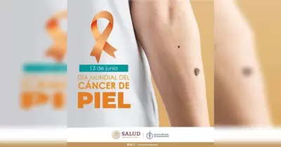 C�ncer de piel