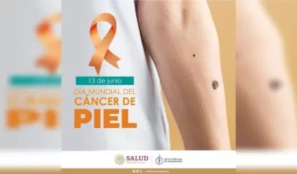 C�ncer de piel