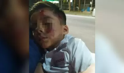 Ni�o atropellado en la colonia Solidaridad