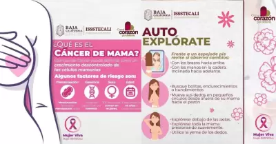 Issstecali invita a mujeres y hombres mayores de 40 a�os a realizarse mamograf�a