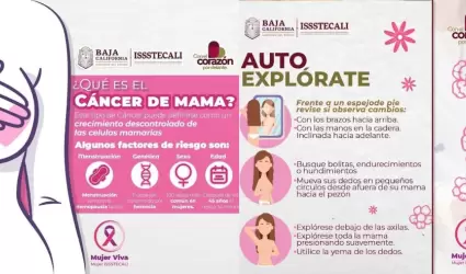 Issstecali invita a mujeres y hombres mayores de 40 a�os a realizarse mamograf�a
