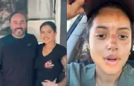 Hija de Lupillo Rivera sufre accidente que le quem� el rostro