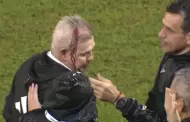 Javier Aguirre result� descalabrado al terminar partido ante Honduras