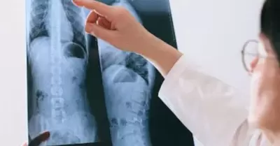 �rea lumbar