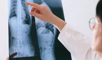 �rea lumbar