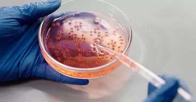 An�lisis de laboratorio, bacterias
