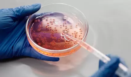 An�lisis de laboratorio, bacterias
