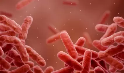 Tuberculosis