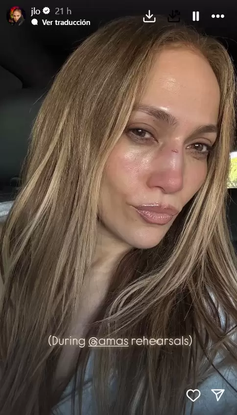 Jennifer Lopez se lastim� el rostro en los ensayos para los premios AMA's