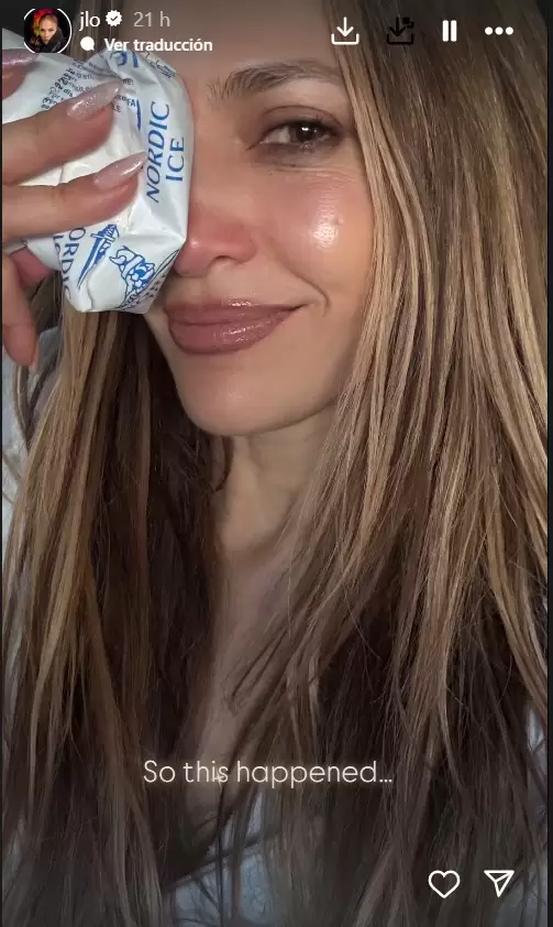 Jennifer Lopez se lastim� el rostro en los ensayos para los premios AMA's