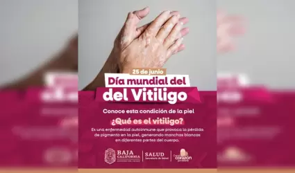 Vit�ligo