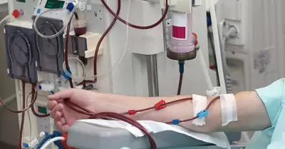 Hemodi�lisis
