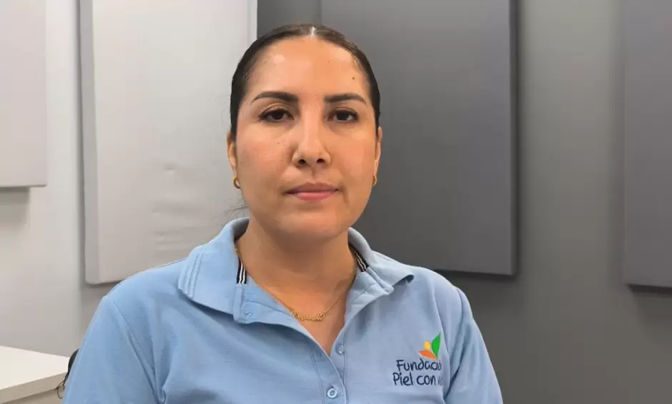 Janeth V�zquez, gerente de la Fundaci�n Piel con Vida