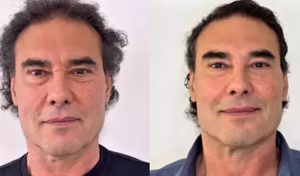 Eduardo Y��ez