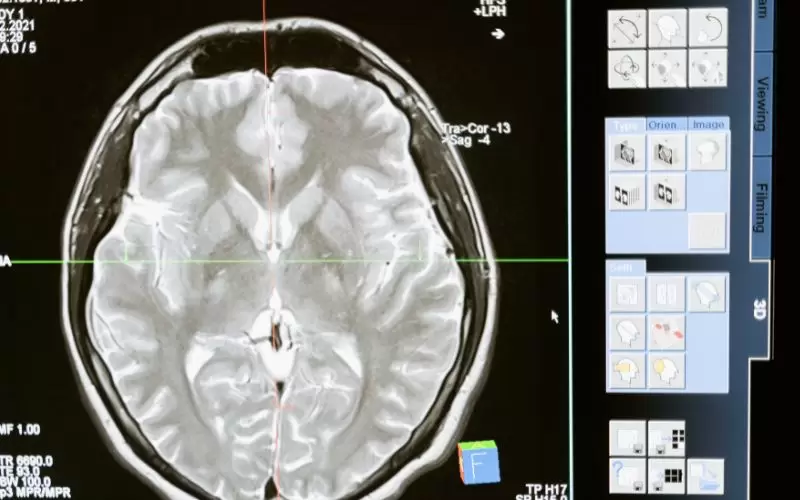 Consecuencias neurol�gicas deterioro cognitivo salud cerebral.