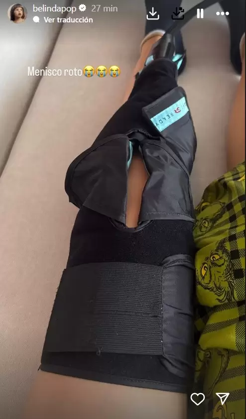 Belinda sufri� una fuerte lesi�n en la pierna