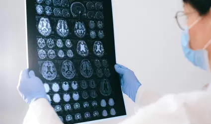 Sensibilizaci�n sobre el Alzheimer