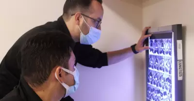 Par�lisis cerebral
