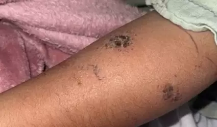 .