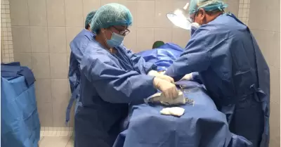 Vasectom�a sin bistur�