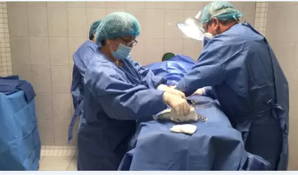 Vasectom�a sin bistur�