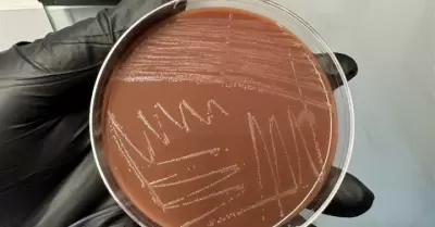 Infecciones de transmisi�n sexual contin�an a la baja