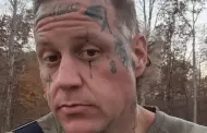 Jelly Roll revela que se fractur� la clav�cula tras un fuerte accidente
